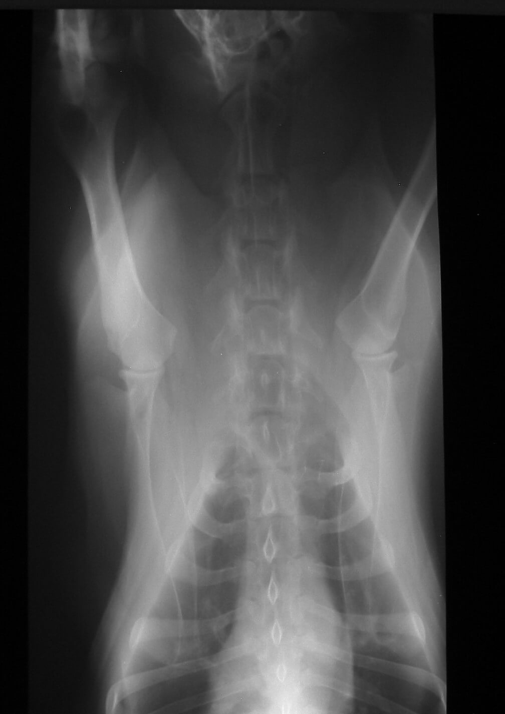 x rays